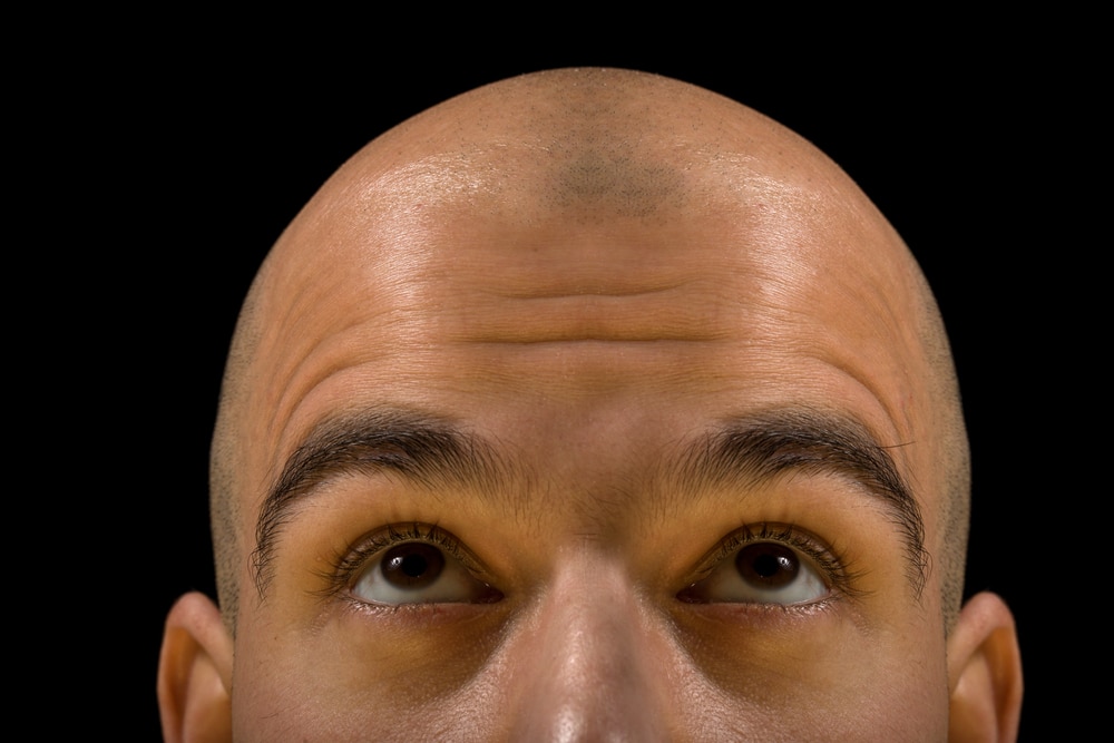 Scalp micropigmentation in Washington DC, Maryland or Virginia blog post image