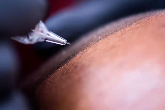 scalp micropigmentation safety cartridge