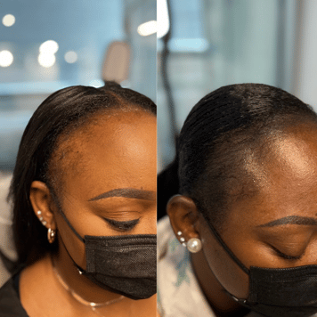 Edge Scalp Ink scalp micropigmentation SMP Maryland DMV Washington DC Virginia